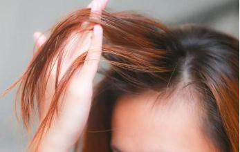 發(fā)質(zhì)細(xì)軟怎么改善  如何改善發(fā)質(zhì)細(xì)軟的問題