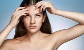 為什么額頭長痘 快來看看原因有哪些