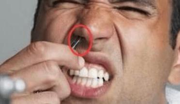 鼻毛變白應該如何診斷？鼻毛變白怎么辦？