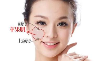 蘋果肌好看還是不好看？女生有蘋果肌好看嗎？
