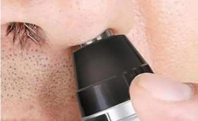 鼻毛變白什么征兆  鼻毛變白是什么征兆