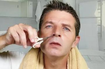 鼻毛變白什么征兆是什么