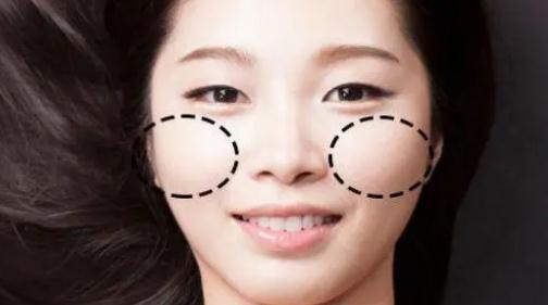 蘋果肌是什么意思 蘋果肌什么樣子（圖片）