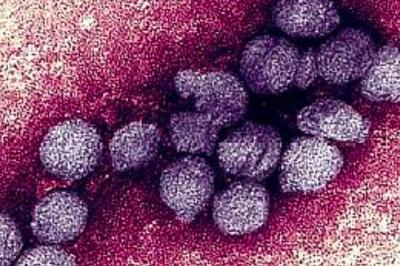 西尼羅病毒席卷多國  全球警戒升級