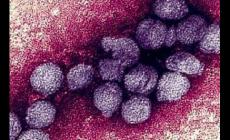 西尼羅病毒席卷多國  全球警戒升級