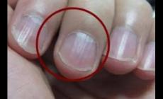 指甲有豎紋是身體的什么信號啊