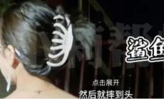 鯊魚(yú)夾是有危害的！女子頭戴鯊魚(yú)夾摔倒后成植物人