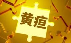 新生兒怎么看黃疸退了沒有 新生兒怎么看黃疸退了沒退