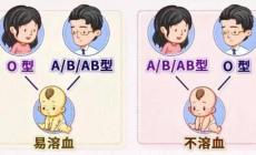 懷孕期間怎么查胎兒有沒有溶血