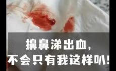 擤鼻涕鼻子經常出血是什么原因  每次擤鼻涕都有血是啥毛病