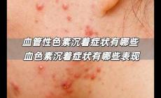 血管性色素沉著癥狀有哪些 血色素沉著癥狀有哪些表現(xiàn)